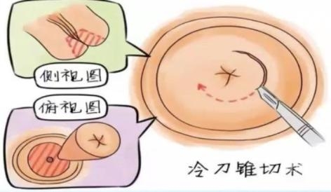 9944cc天下彩正版资料大全做了锥切手术可以吃芒果9944cc天下彩正版资料大全-第2张图片