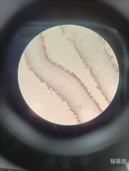 手指虎口处按压酸疼手指虎，神秘的生物-第3张图片